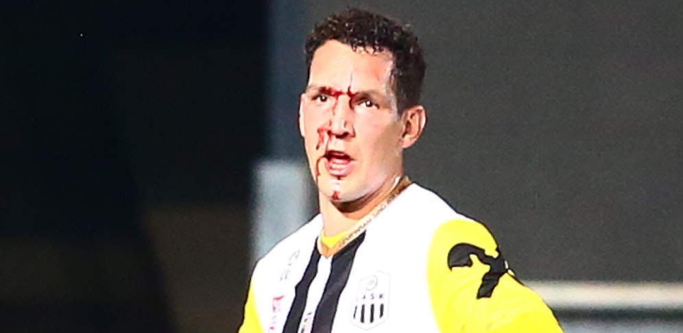 Schwer gezeichnet: LASK-Verteidiger Emanuel Pogatetz