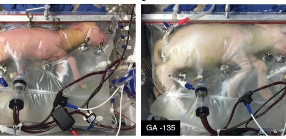 Künstliche Gebärmutter für Schaf-Frühchen