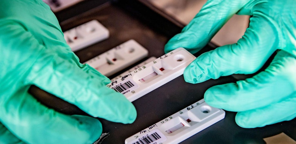 Mit Antikörper-Tests lässt sich feststellen, ob eine Person Kontakt mit dem Coronavirus hatte und somit immun ist. 