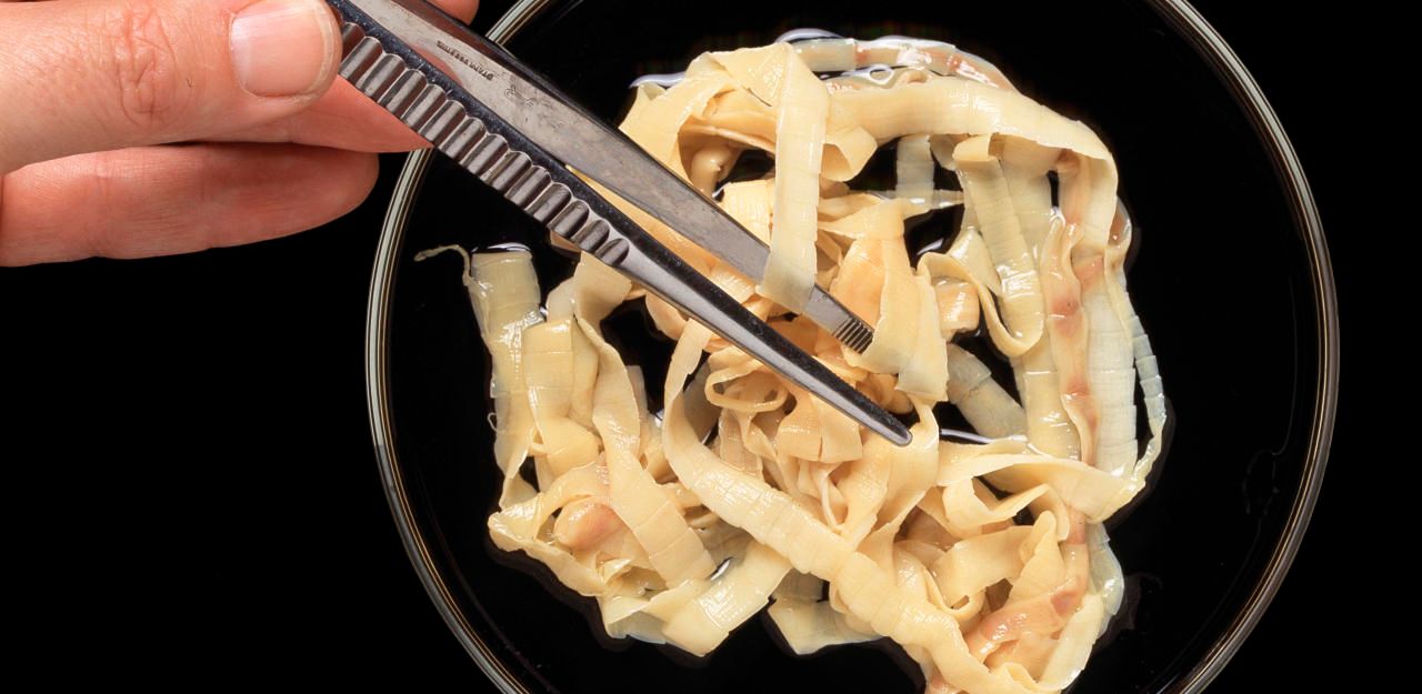 Heute.at - Mann zieht sich 9,7-Meter-Bandwurm aus dem Po