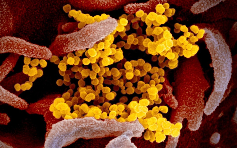 Das Corona-Virus wird uns noch monatelang in Atem halten.