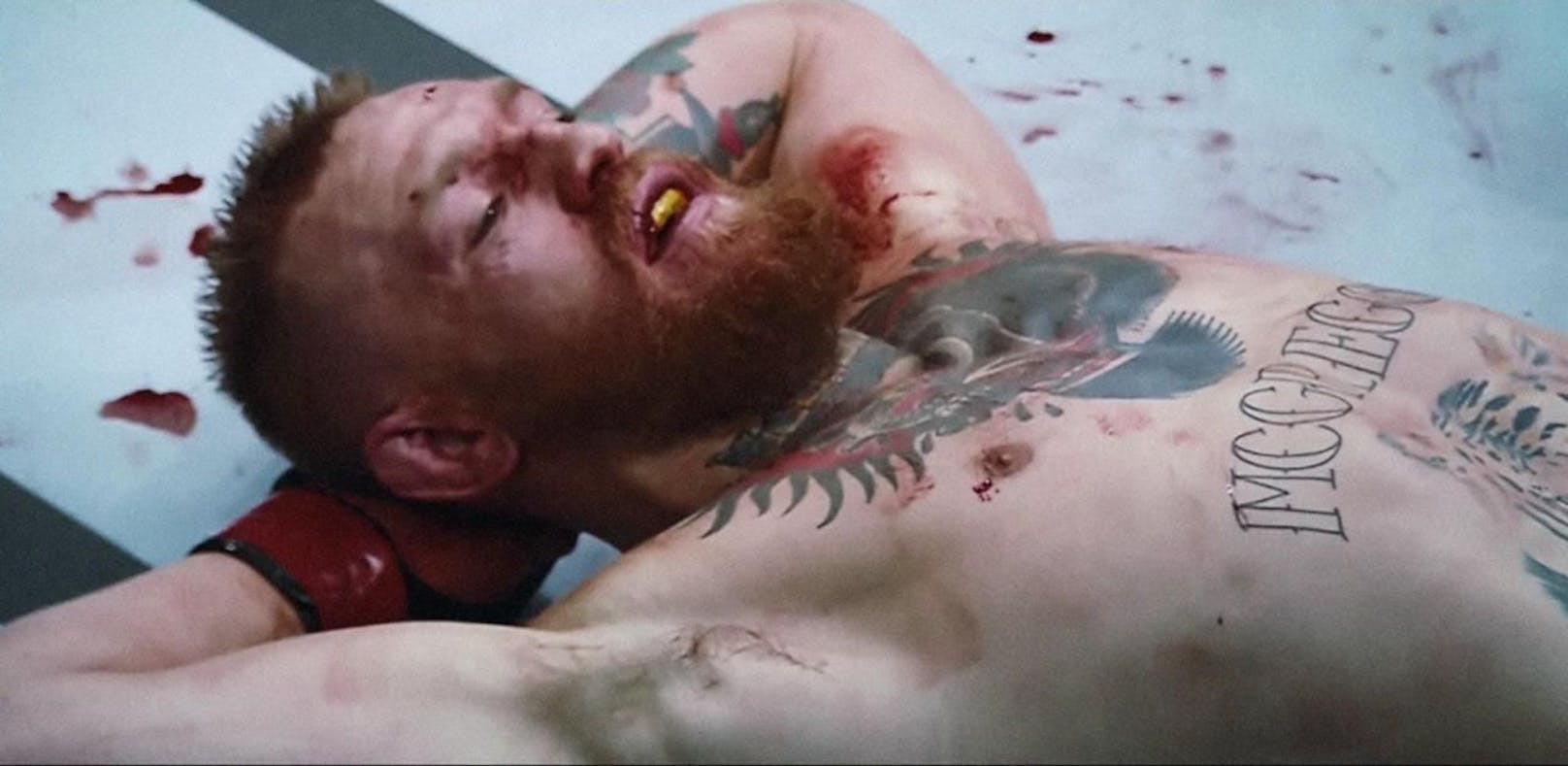 McGregor in Haft! Fighter bei Bus-Attacke verletzt