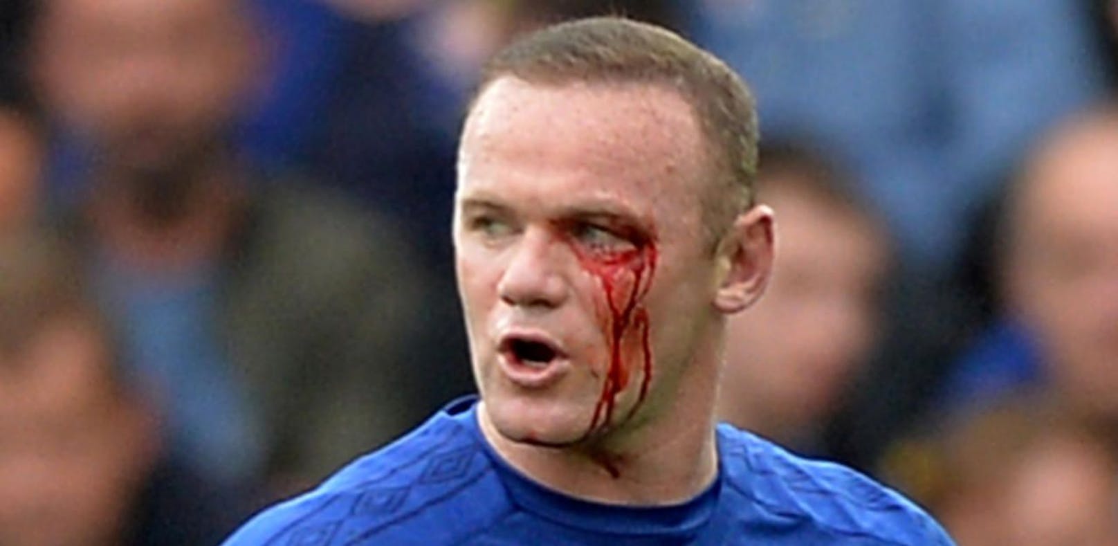 Auge verletzt: Rooney schockt mit "Blut-Spiel"