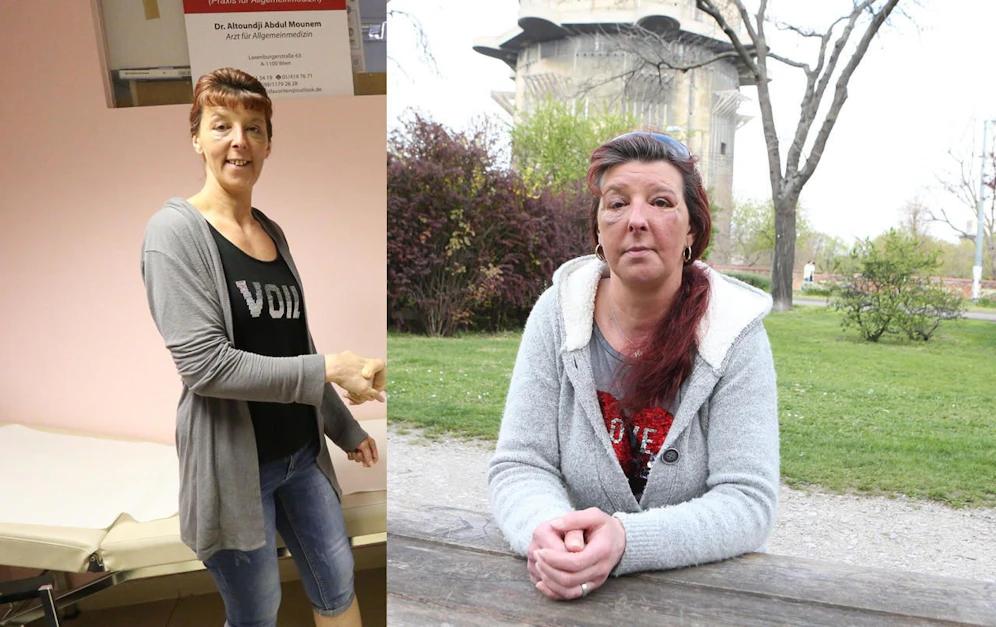 Jasmin M. vor (l.) und nach der Operation.
