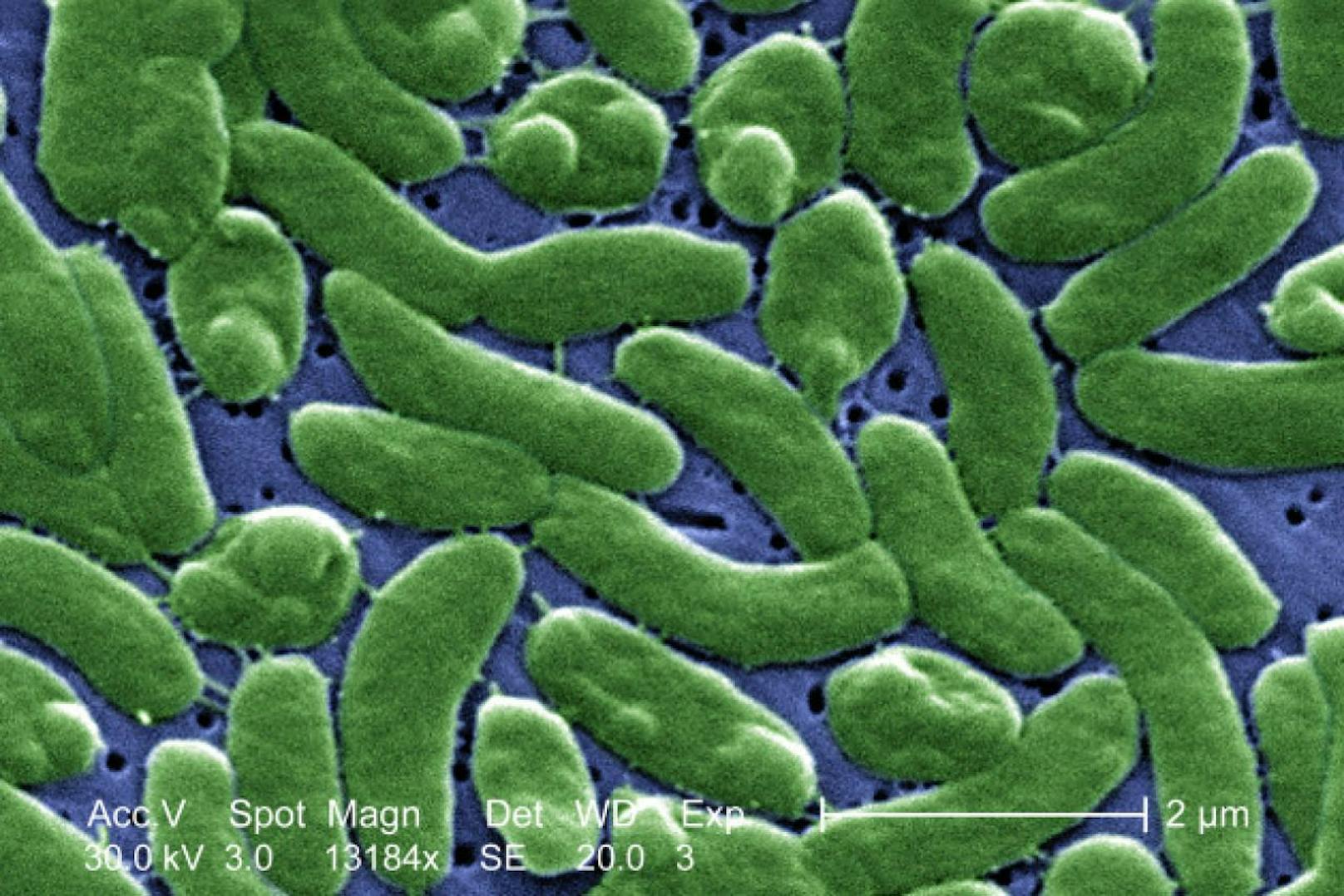 Tödlich: Das Bakterium &quot;Vibrio vulnificus&quot; ist eng mit dem Cholera-Auslöser verwandt. 