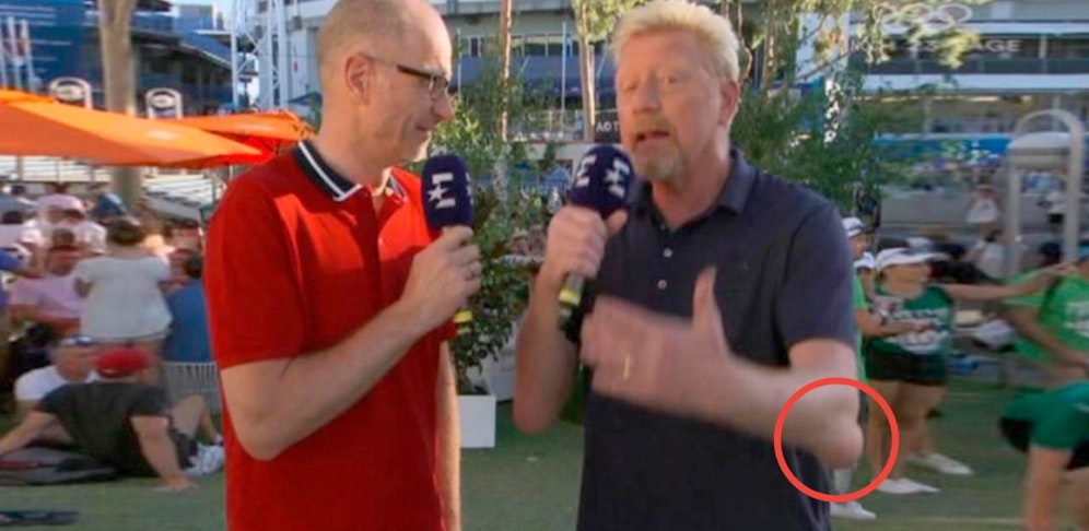 Nichts für zartbesaitete Gemüter - die Beulen an Boris Beckers Ellbogen 