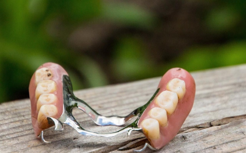 In Urfahr wurde eine Zahnprothese gefunden.