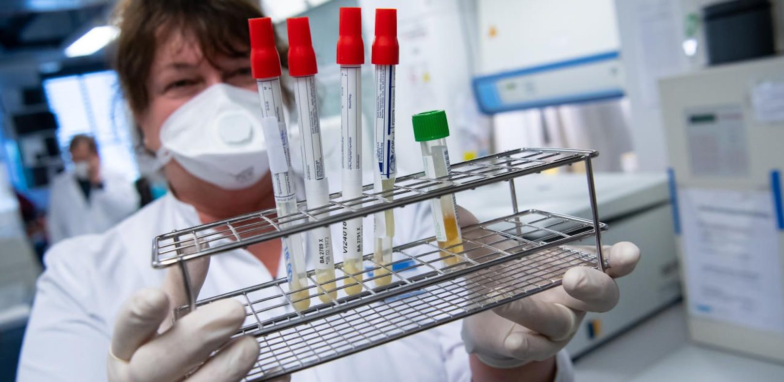 Eine Mitarbeiterin am Institut für Virologie der technischen Universität München (TUM) bereitet Proben von Menschen mit Covid-19 Verdacht in einem Labor für die weitere Analyse vor. (Symbolbild)