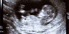Schlimme Auswirkungen durch Covid-19 in Schwangerschaft