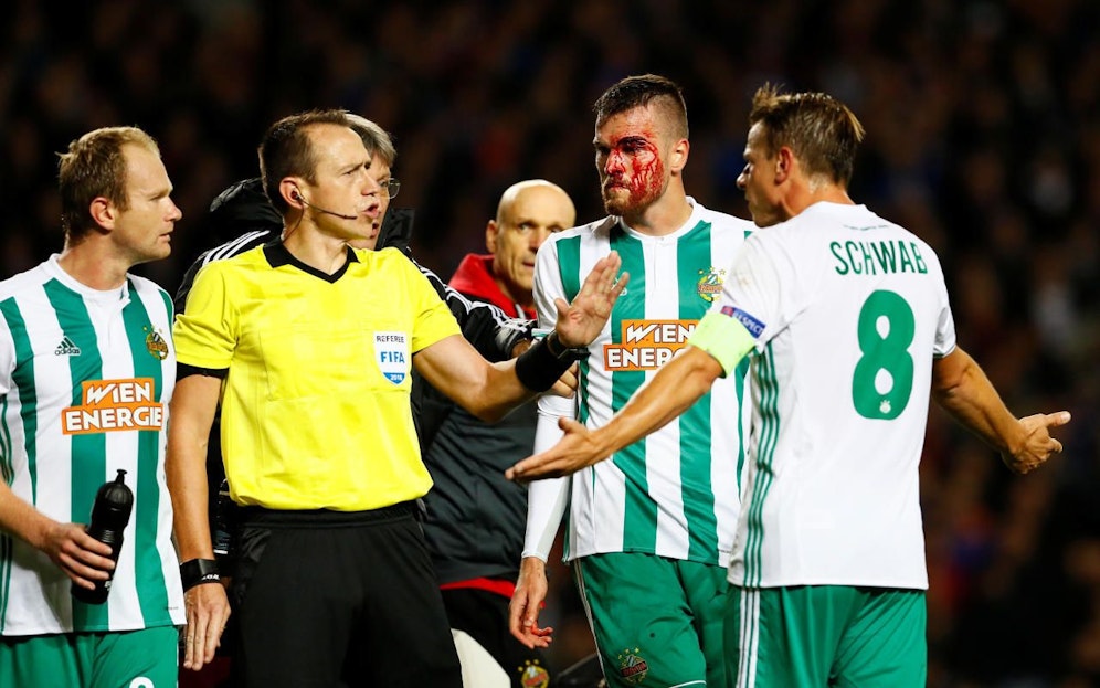 Mateo Barac blutüberströmt