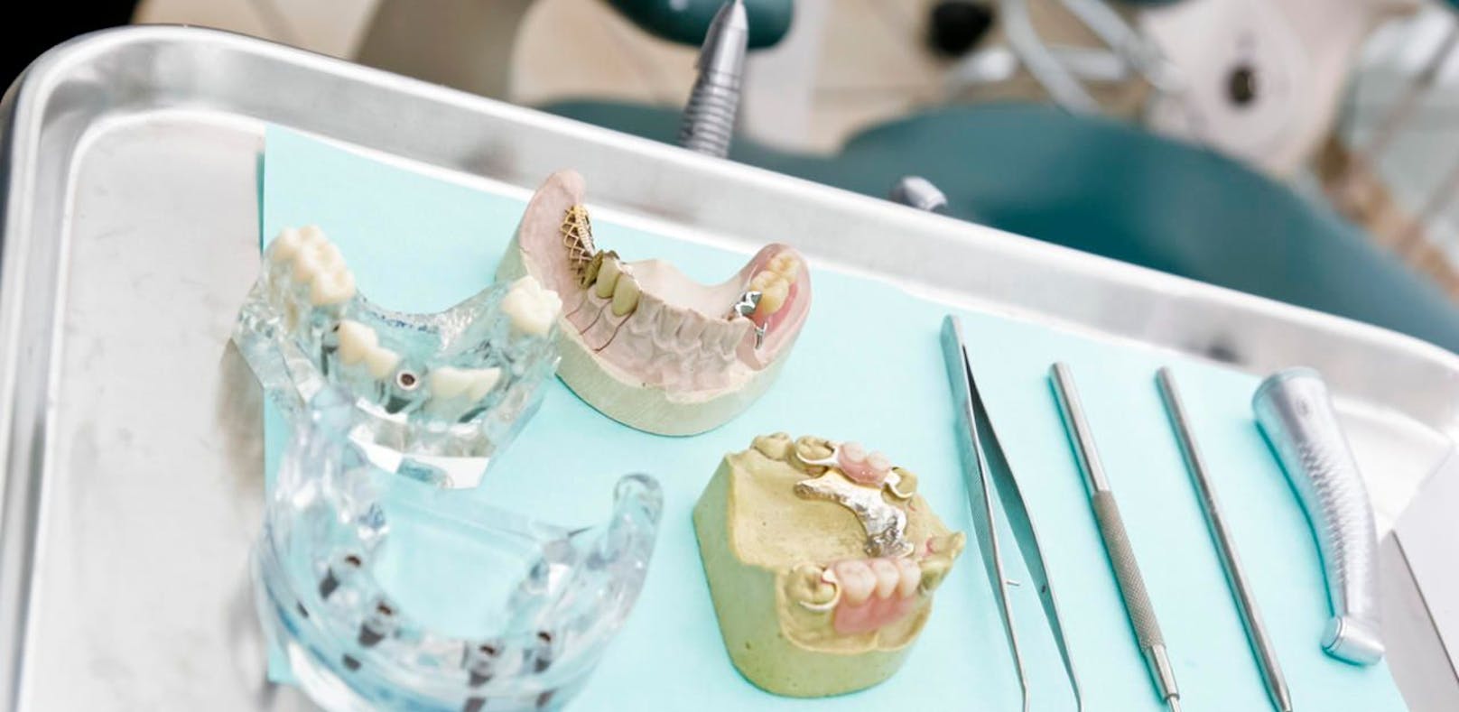 Frau war zum Schnuppern in der Zahnarztpraxis, dann folgte die böse Überraschung. 