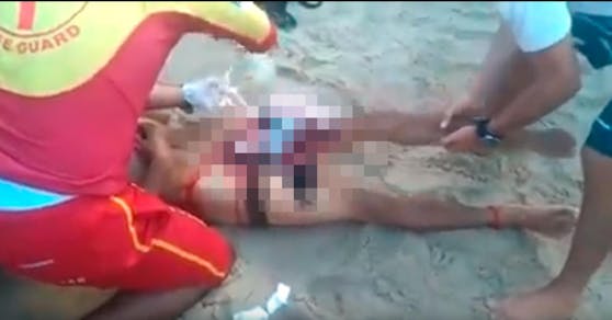 Videoaufnahmen zeigen, wie der schwer verletzte Jugendliche am Strand versorgt wird.