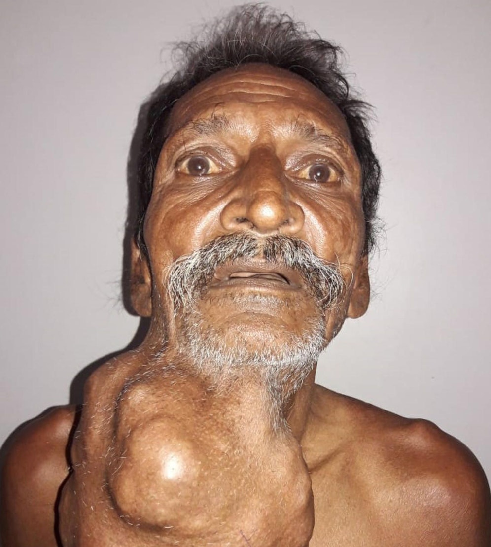 Somai mit seinem Tumor. Credit: SWNS