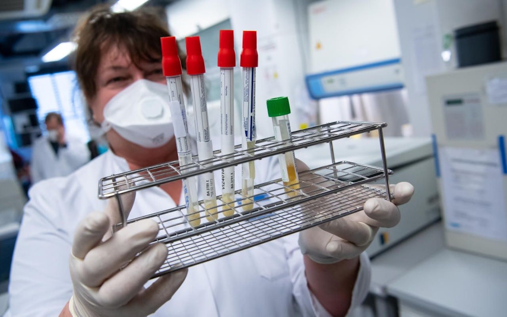 Stand Sonntag, 5. April 2020, 10.00 Uhr, sind in Wien 1.732 Erkrankungen bestätigt. Damit flacht die Kurve der Neuerkrankungen weiter ab.