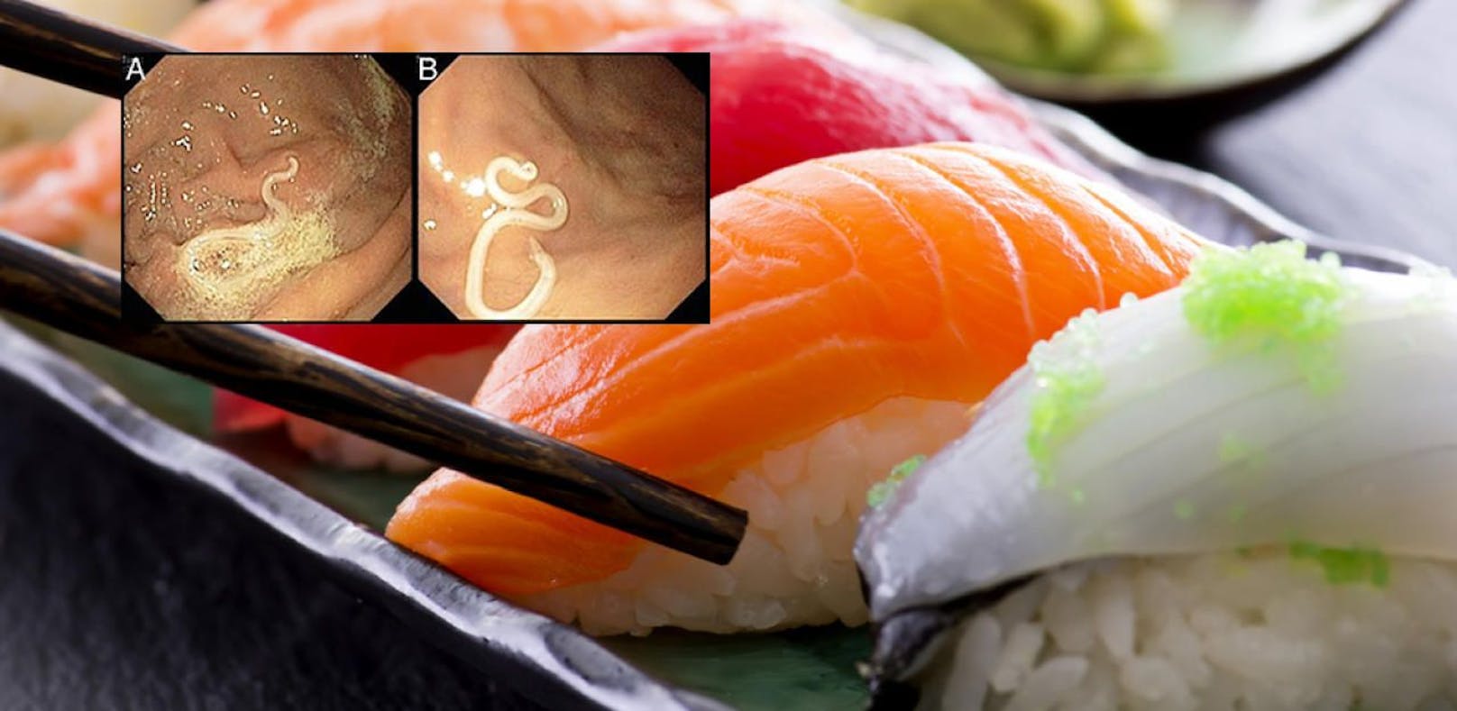 Sushi kann mit Parasiten verunreinigt sein.