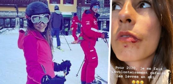 Marion Grosjean verletzte sich beim Skifahren.