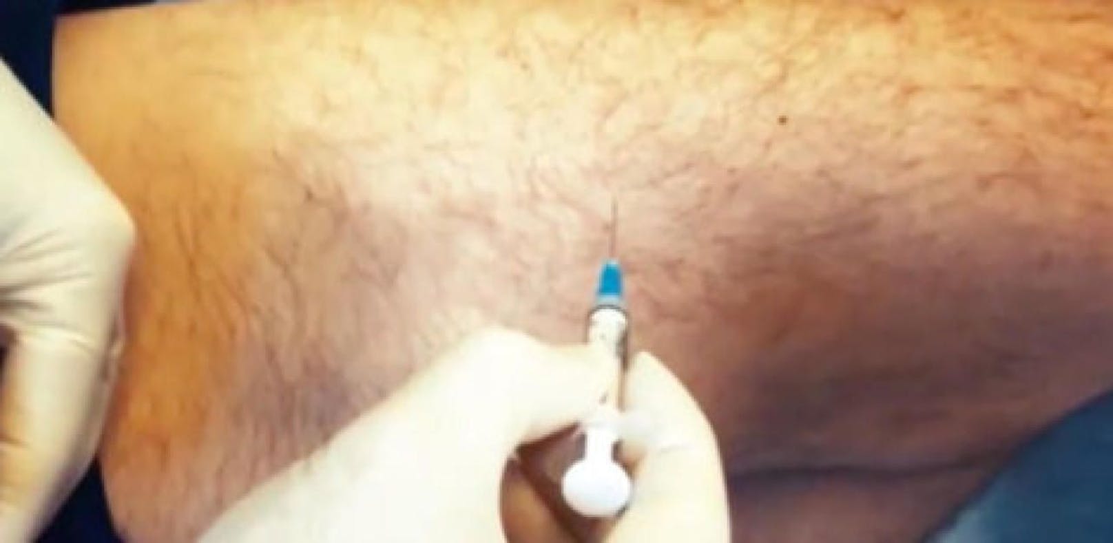 Schweizer testet Corona-Impfstoff an sich selbst