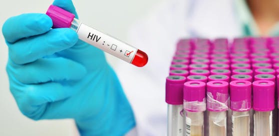 Auch das Opfer ist nun HIV-positiv