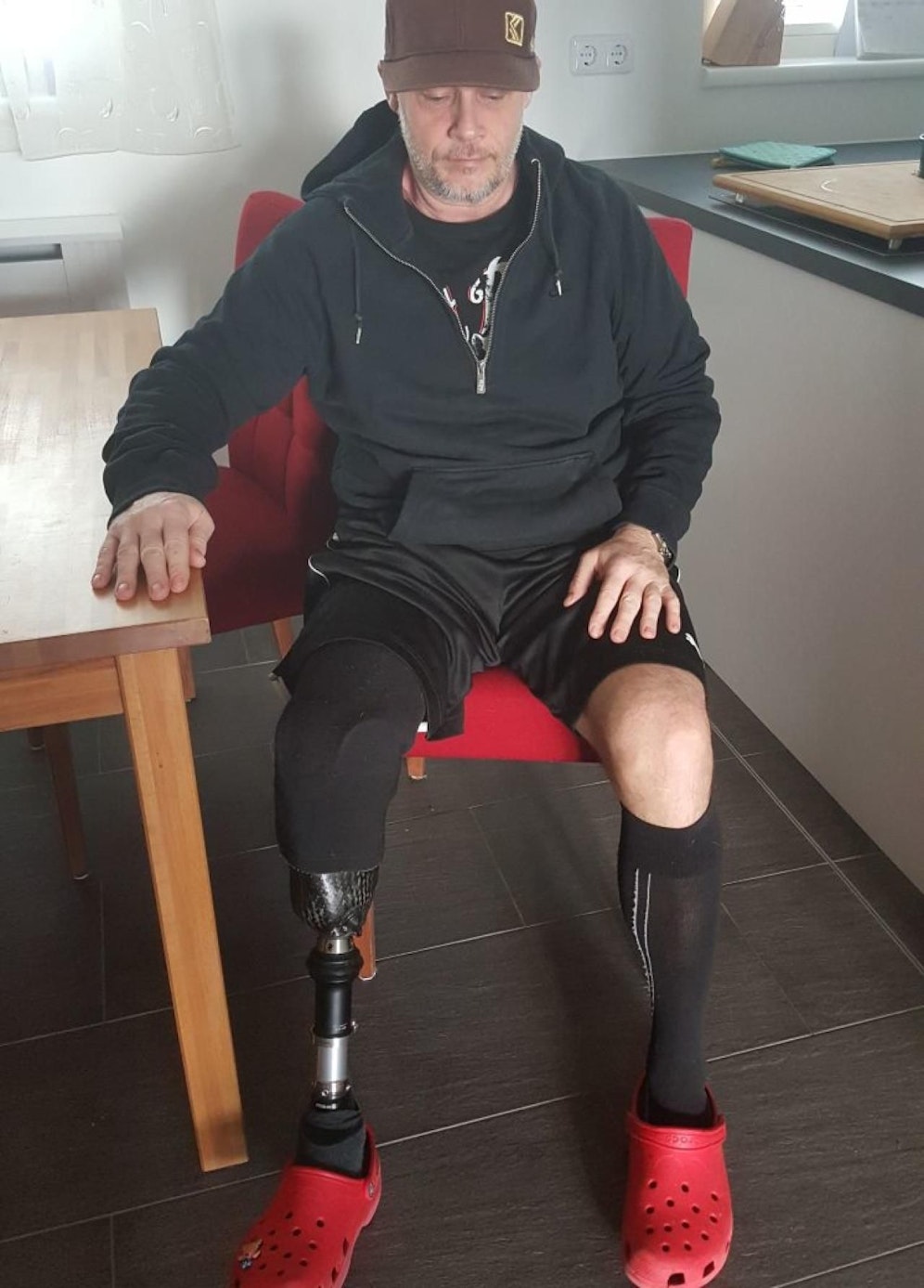 Das rechte Bein wurde unterhalb des Knies amputiert.