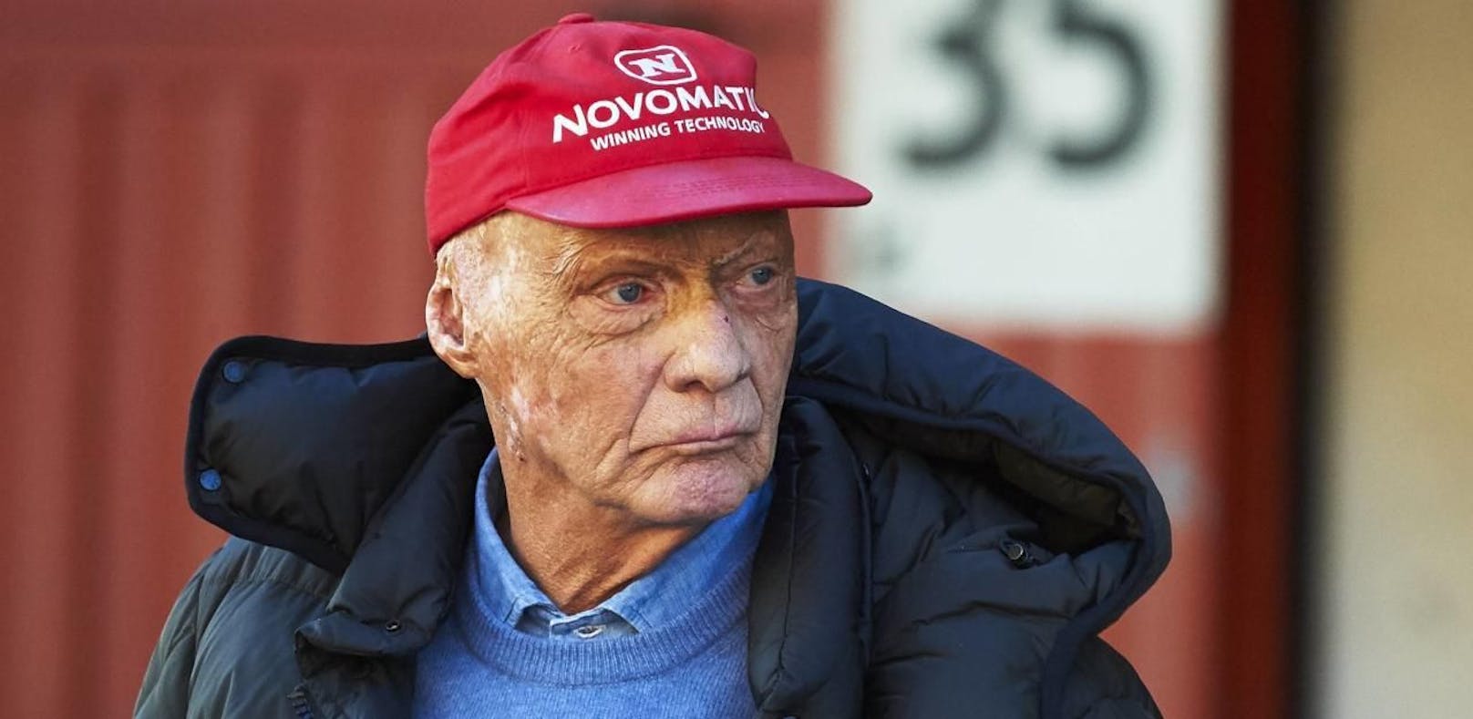 Zustand ernst! Niki Lauda bekam neue Lunge