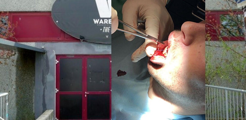 Das Opfer musste nach der Attacke im Warehouse im Spital genäht werden.