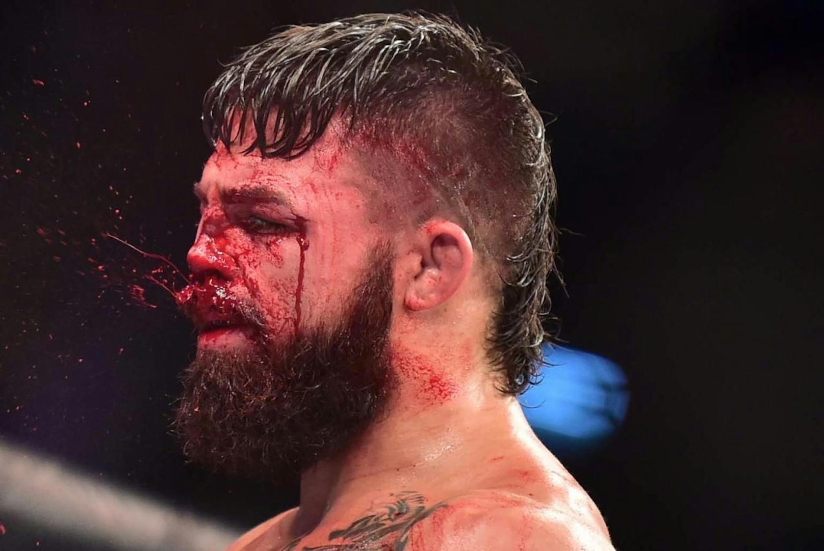 UFC-Fighter Mike Perry schwer gezeichnet
