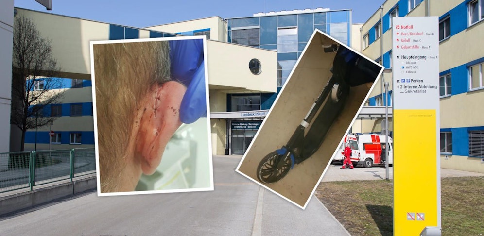 Das Verletzte Ohr des Opfers, sein Roller und das Spital Wr. Neustadt.