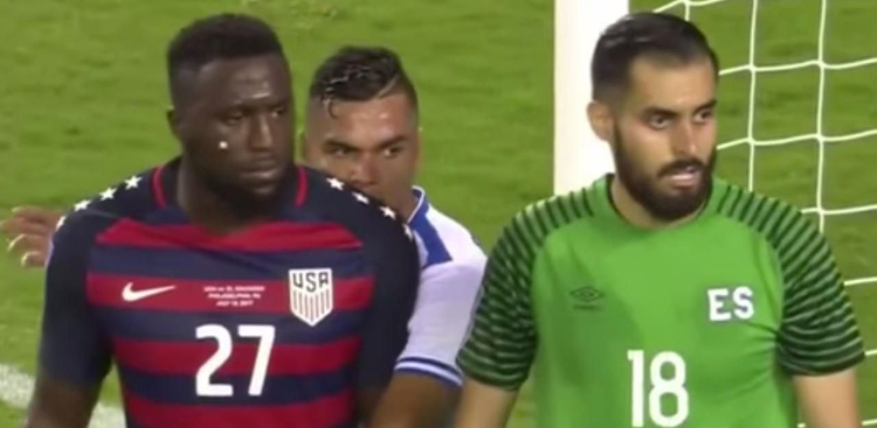 Heute.at - Biss-Attacke! Skandal um Romero beim Gold Cup