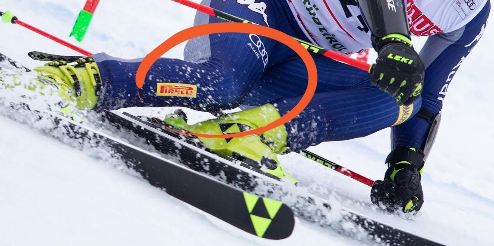 Das Kreuzband ist im Ski-Sport schwer gefährdet. 
