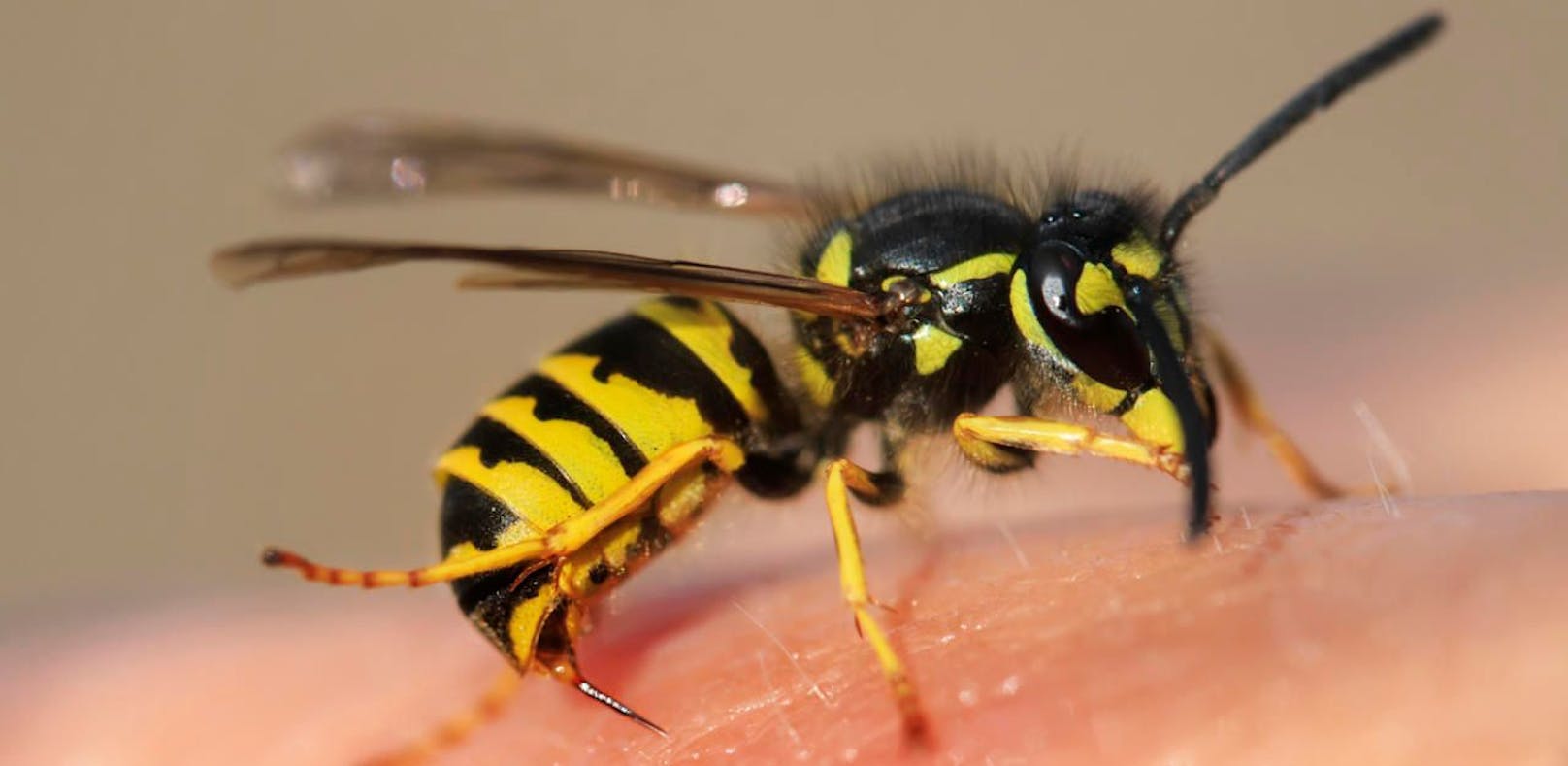 Ein Wespenstich kann für Allergiker lebensbedrohlich enden. (Symbolbild)
