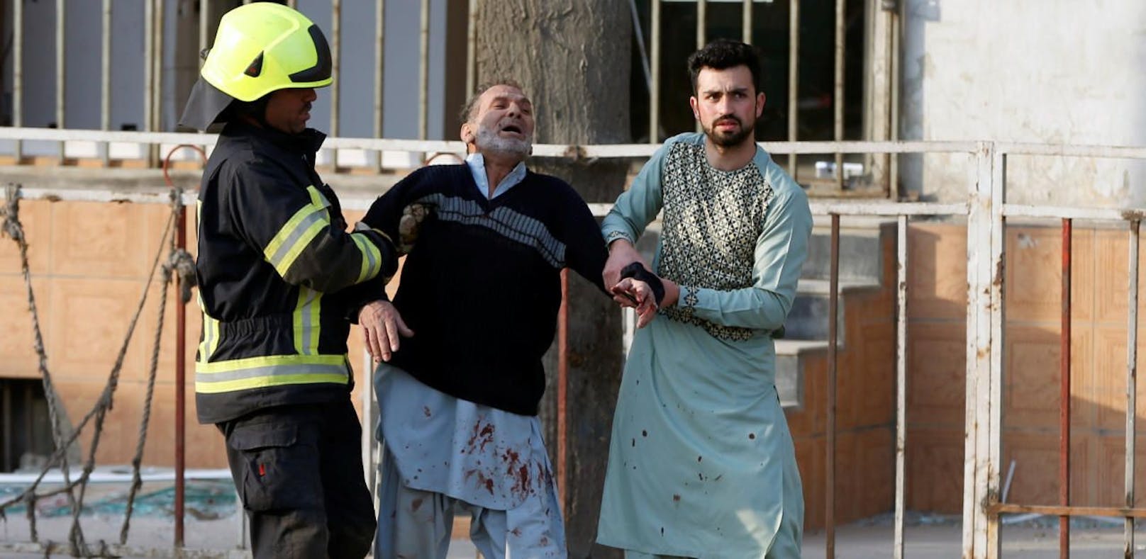 63 Tote und 151 Verletzte bei Taliban-Anschlag