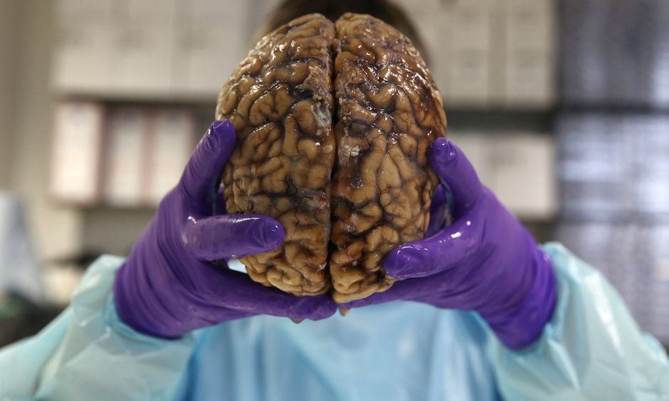 Heute.at - Hirn-fressende Amöbe schlägt wieder zu!