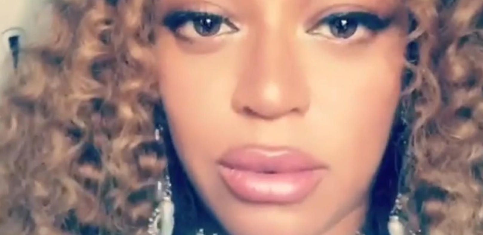 Hat Beyoncé ihre Lippen aufspritzen lassen?