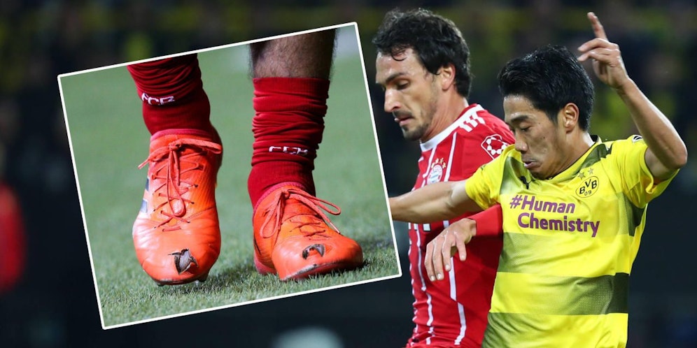 Brutal! Um die Zehen zu entlasten, schnitt Hummels Löcher in seine Schuhe.