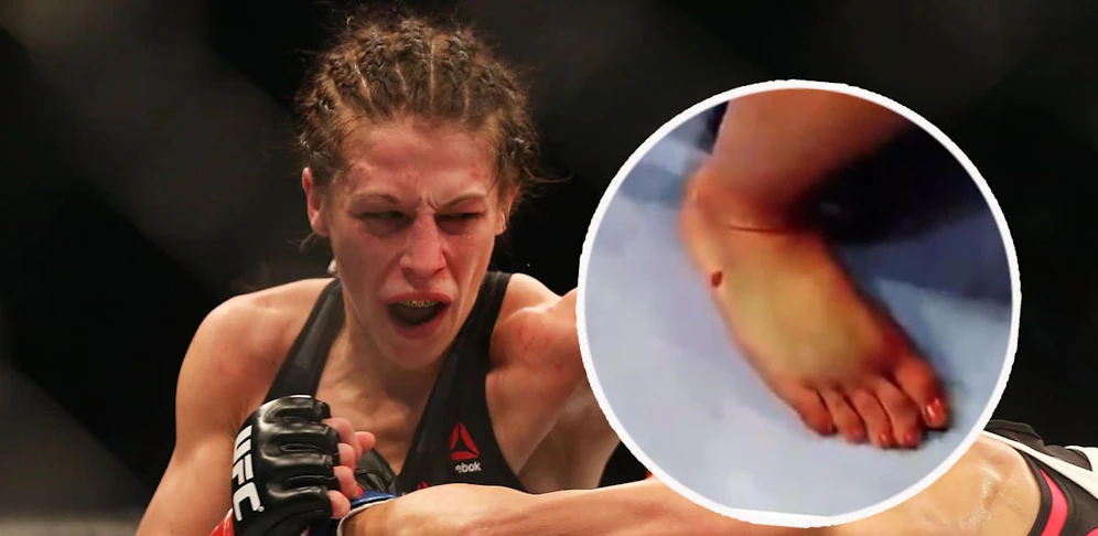 Joanna Jedrzejczyk siegte trotz eines gebrochenen Fußes.