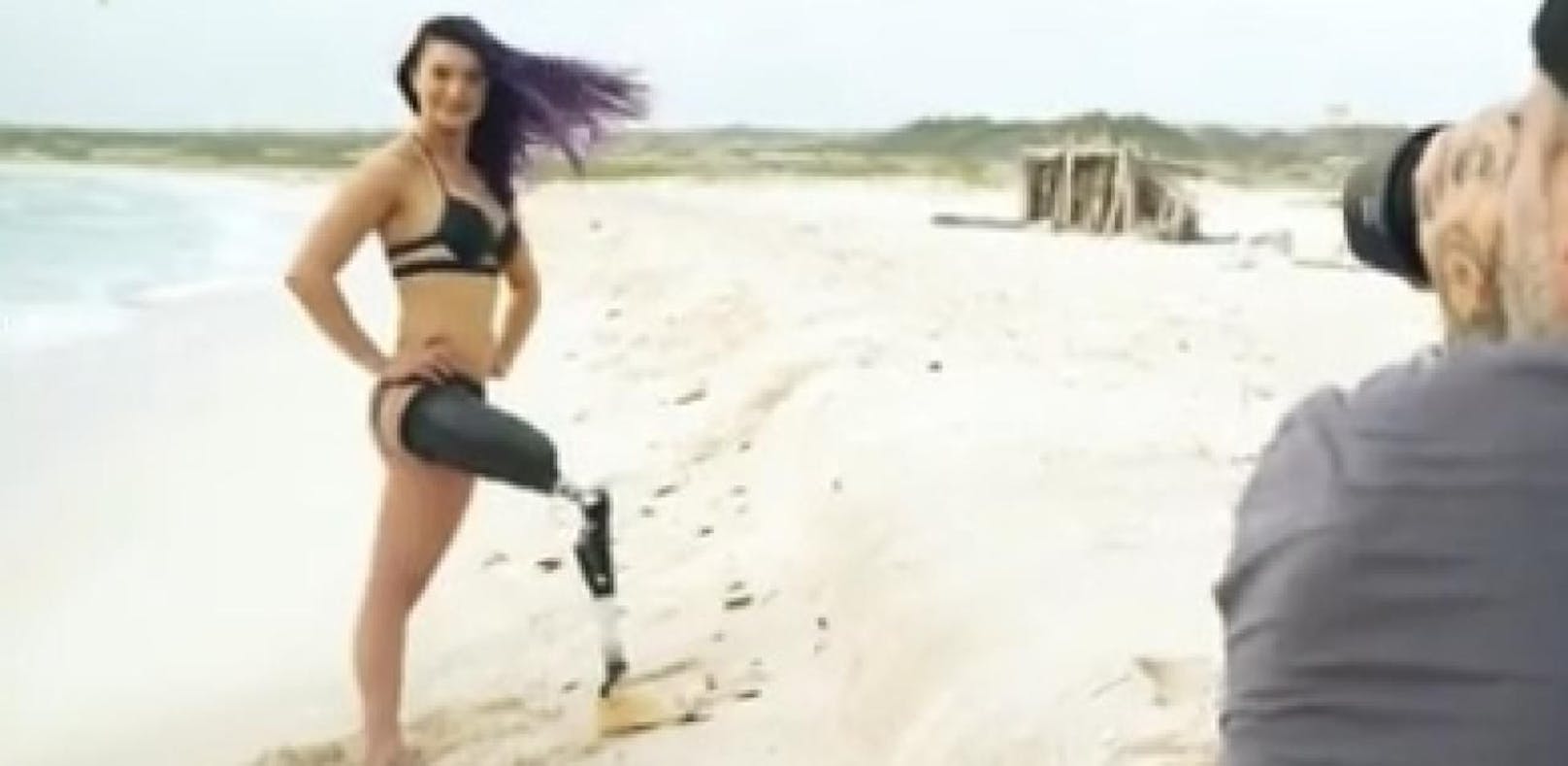 Paralympics-Star posiert mit Beinprothese im Bikini