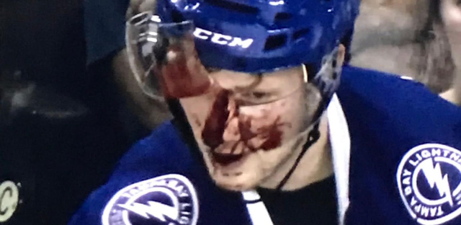 Schock-Verletzung in der NHL: Gesicht zerschnitten