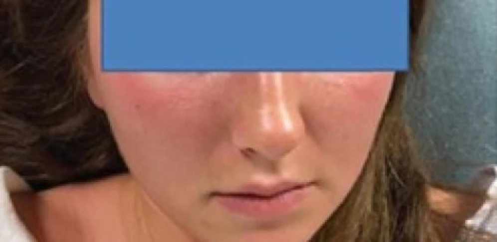 Obwohl sich die 16-Jährige bereits seit drei Tagen krank fühlte und über Schmerzen, Kurzatmigkeit und Übelsein klagte, konnten die Mediziner in der Notaufnahme nichts feststellen. Sie schickten sie nach Hause, was das Mädchen fast das Leben gekostet hätte.