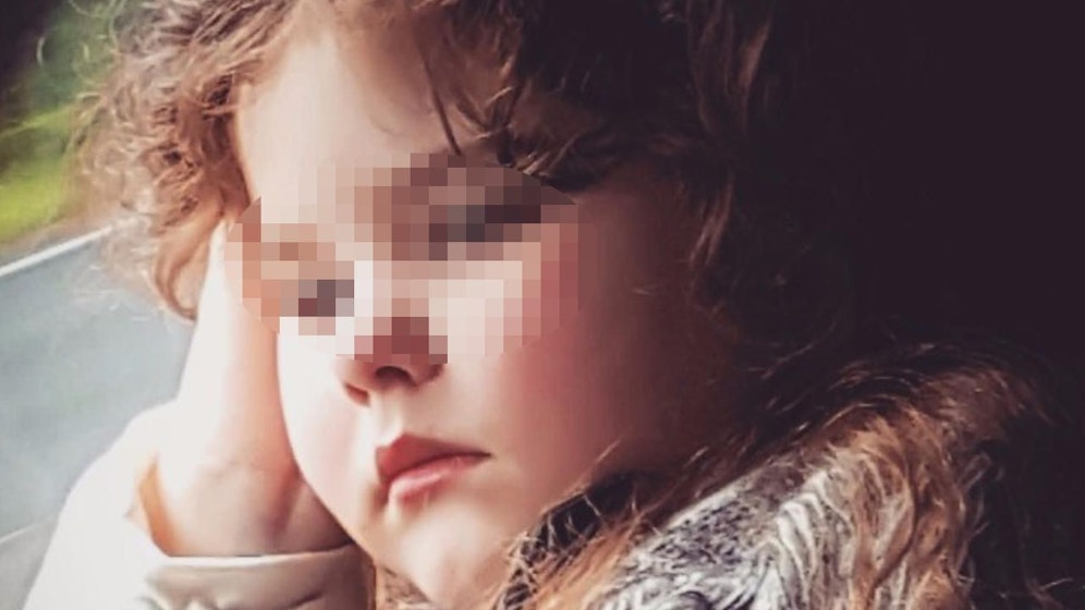 Arme Emily: Die süße Australierin leidet an dem seltenen Addison-Syndrom. Obwohl sie erst fünf Jahre alt ist, steckt sie schon in der Pubertät!