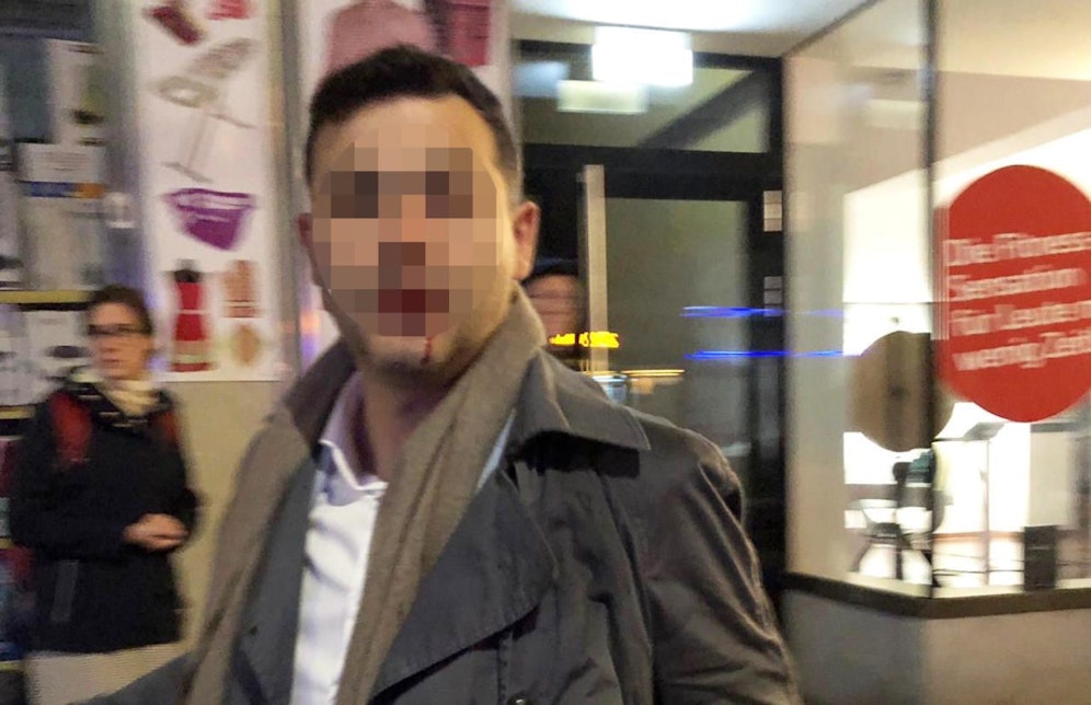 Das Opfer erlitt einen Nasenbeinbruch.