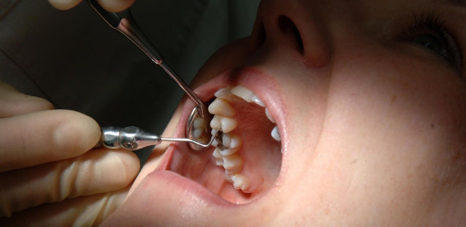 Mit starkem Zahnweh musste ein Frau sich auf Arztsuche begeben.