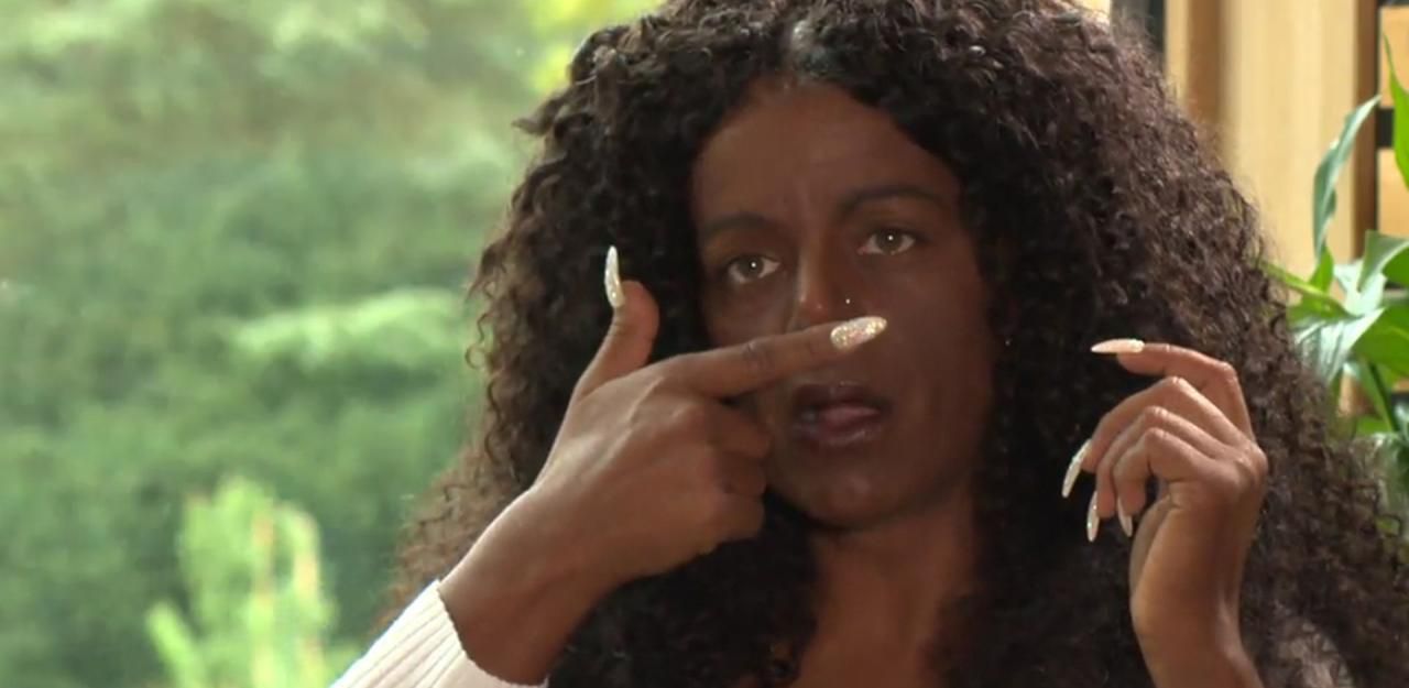 Heute.at - Nasen-OP verweigert: Martina Big gibt Update