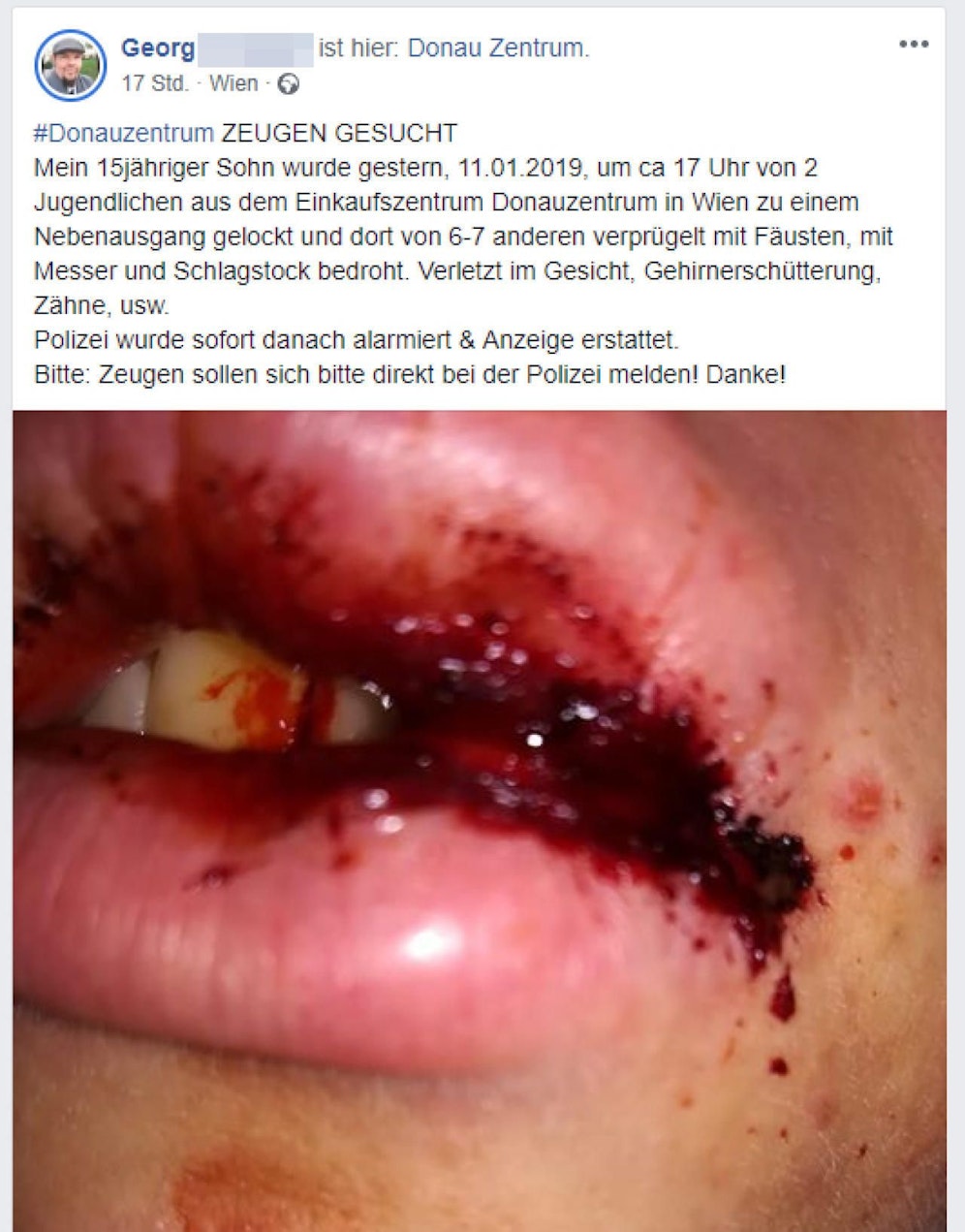 Auf Facebook suchte Georg G. nach Zeugen: Wer hat die Attacke am Freitagnachmittag im Donauzentrum gesehen?