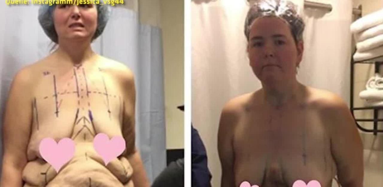 Heute.at - 90 Kilo weniger: Bloggerin zeigt Verwandlung im Netz