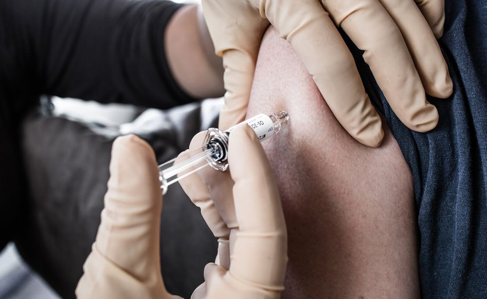 HPV-Impfung ab 2023 bis zum 21. Lebensjahr gratis