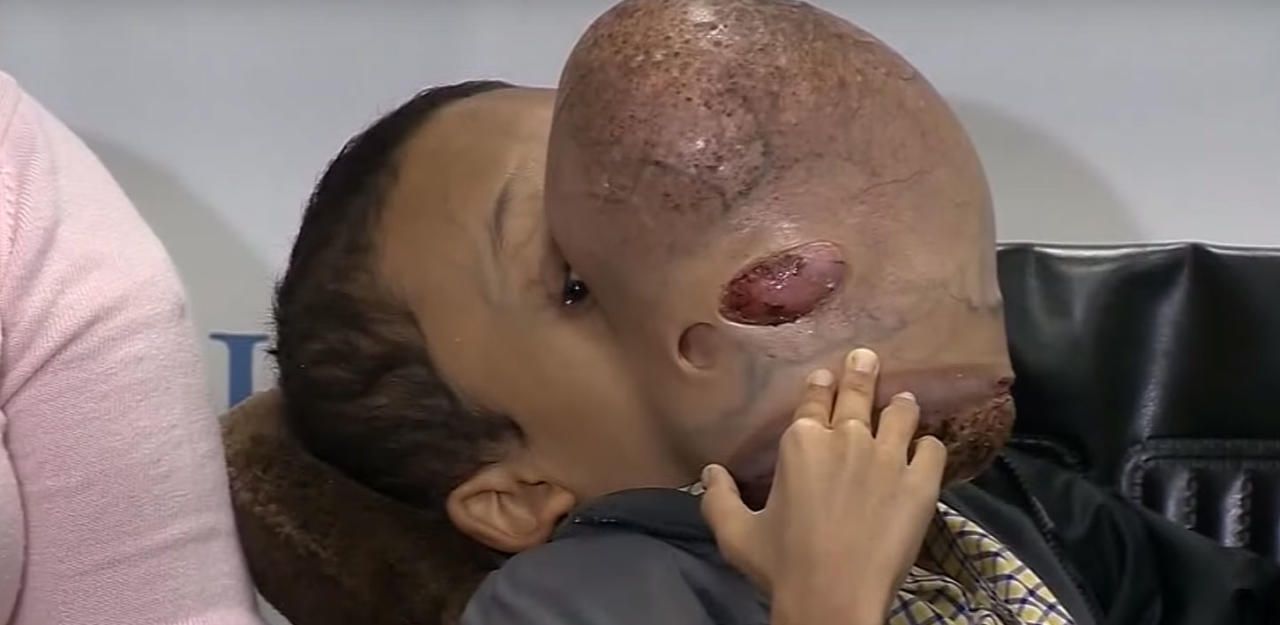 Heute.at - Emanuel verlor Kampf gegen 5-Kilo-Tumor