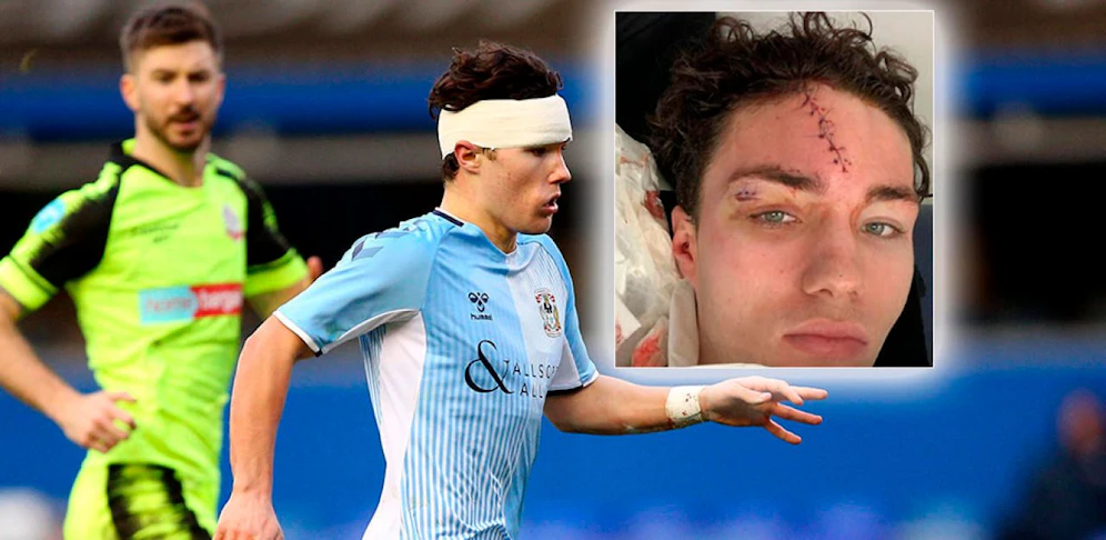 Coventry-Star Callum O'Hare nahm von der Partie gegen Bolton ein ganz besonderes Andenken mit. 