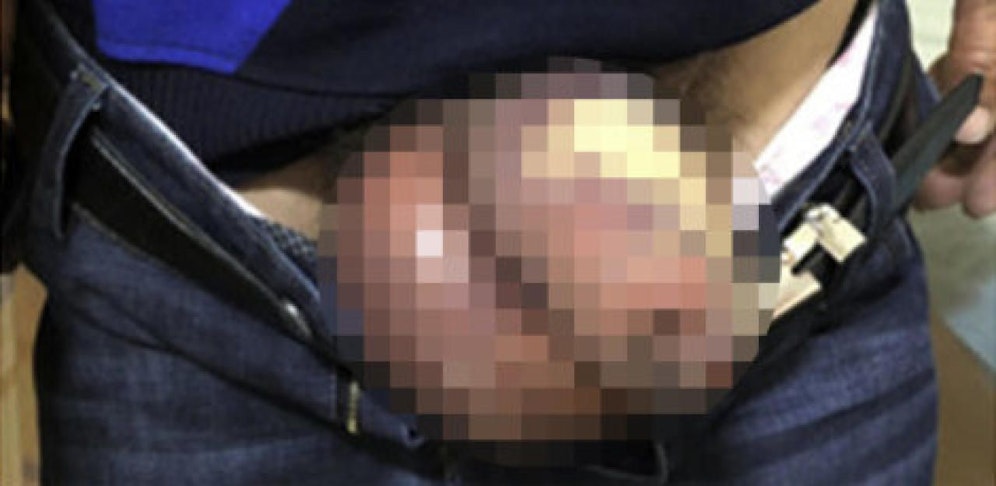 Urology Case Reports/KaiminGuob