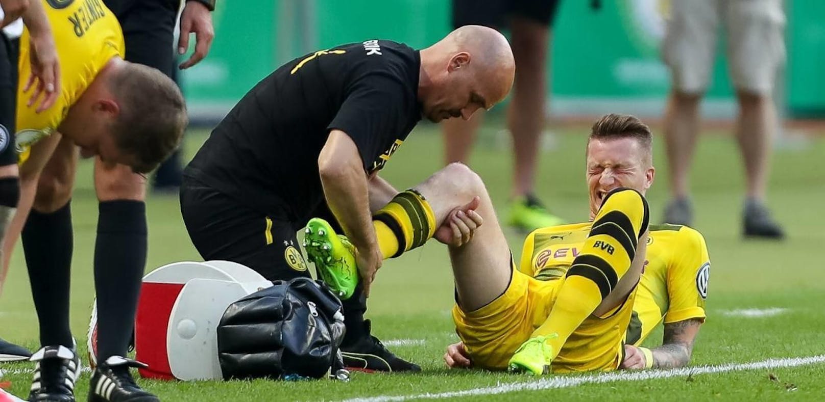 Sein Gesicht spricht Bände - Marco Reus droht erneut wegen einer Knieverletzung eine lange Zwangspause. 