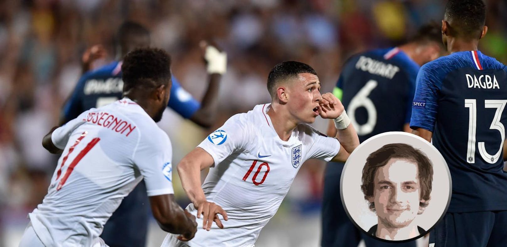 Frankreich besiegte England in einem dramatischen U21-Match. Leider ließ die Übertragung zu wünschen übrig.
